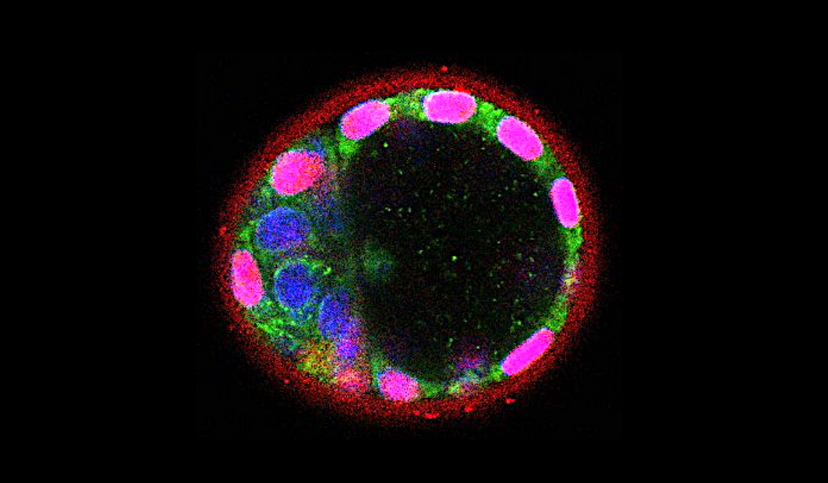 Ealry stages embryo